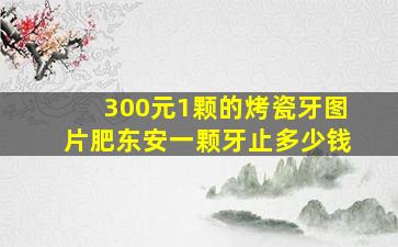 300元1颗的烤瓷牙图片肥东安一颗牙止多少钱