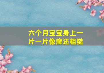 六个月宝宝身上一片一片像癣还粗糙