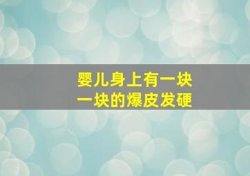 婴儿身上有一块一块的爆皮发硬