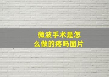 微波手术是怎么做的疼吗图片