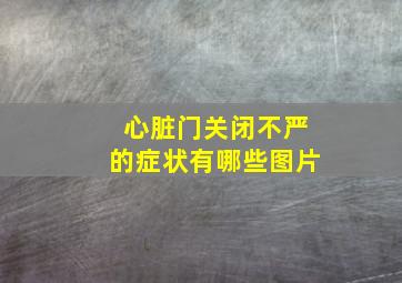 心脏门关闭不严的症状有哪些图片