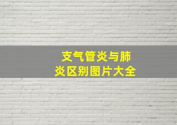 支气管炎与肺炎区别图片大全