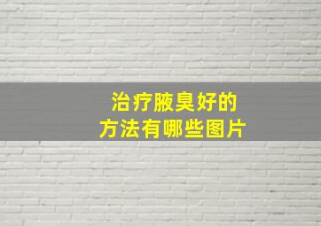 治疗腋臭好的方法有哪些图片