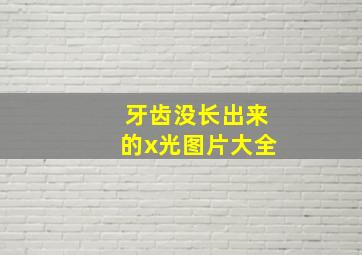 牙齿没长出来的x光图片大全