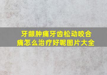 牙龈肿痛牙齿松动咬合痛怎么治疗好呢图片大全