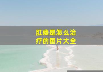 肛瘘是怎么治疗的图片大全