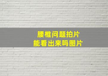 腰椎问题拍片能看出来吗图片