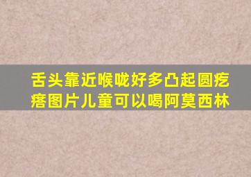 舌头靠近喉咙好多凸起圆疙瘩图片儿童可以喝阿莫西林