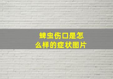 蜱虫伤口是怎么样的症状图片